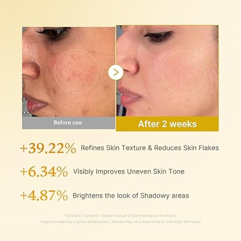 MEDICUBE KOJIC ACID TURMERIC TONER FOR FACE BODY NIACINAMIDE, GLYCOLIC ACID, 8.45 FL OZ