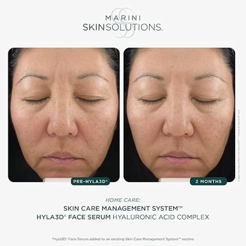 MARINI SKINSOLUTIONS HYLA3D FACE SERUM WITH PATENTED HYALURONIC ACID FOR HYDRATION ANTI-AGING