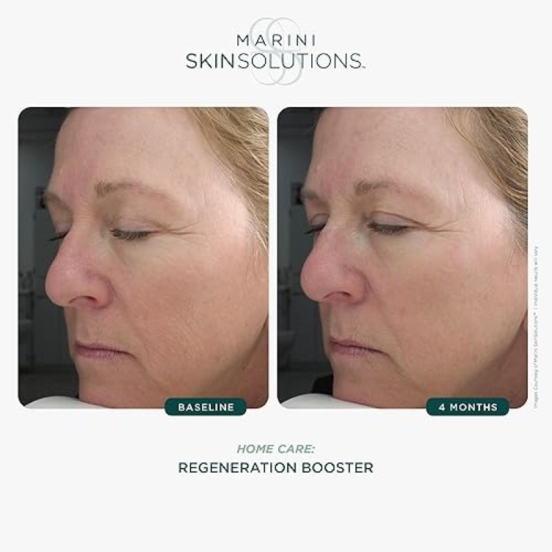 MARINI SKINSOLUTIONS REGENERATION BOOSTER FACE LOTION ANTI-AGING PEPTIDES ANTIOXIDANTS