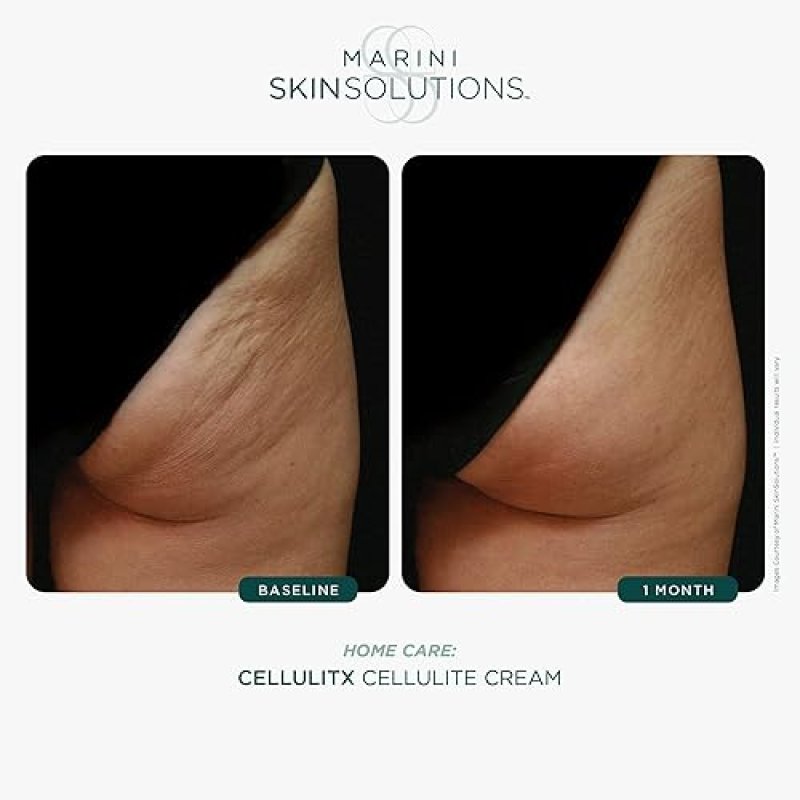 MARINI SKINSOLUTIONS CELLULITX THIGH CREAM WITH AMINOPHYLLINE, RETINOL CAFFEINE 4 OZ