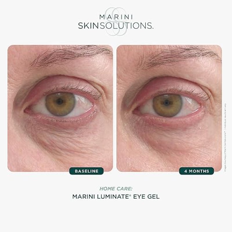 MARINI SKINSOLUTIONS LUMINATE EYE GEL WITH RETINOL PEPTIDES FOR DARK CIRCLES WRINKLES 0.5OZ