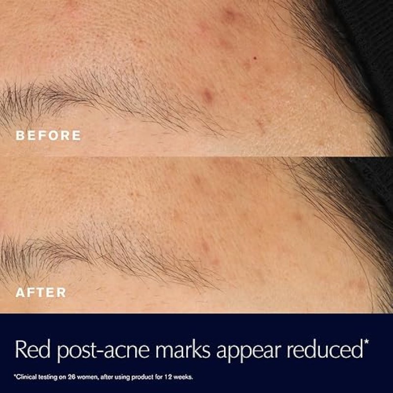 ESTéE LAUDER ADVANCED NIGHT REPAIR RESCUE SOLUTION 0.68OZ WITH 15 BIFIDUS FERMENT FOR REDNESS REDUCT