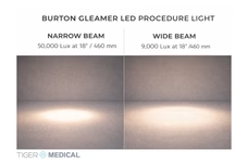 TIGERMEDICAL TABLE MOUNT GLEAMER LED PROCEDURE LIGHT