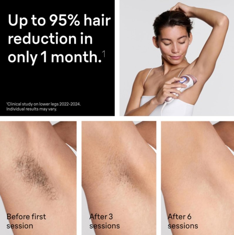 BRAUN SKIN I-EXPERT SMART IPL LASER HAIR REMOVAL FOR WOMEN MEN WITH APP, TRIMMER RAZOR