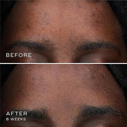 MEDIK8 OXY-R PEPTIDES SERUM 0.3 OZ DARK SPOT CORRECTOR WITH TWIN PEPTIDES, GLUTEN-FREE, GENTLE ON SE