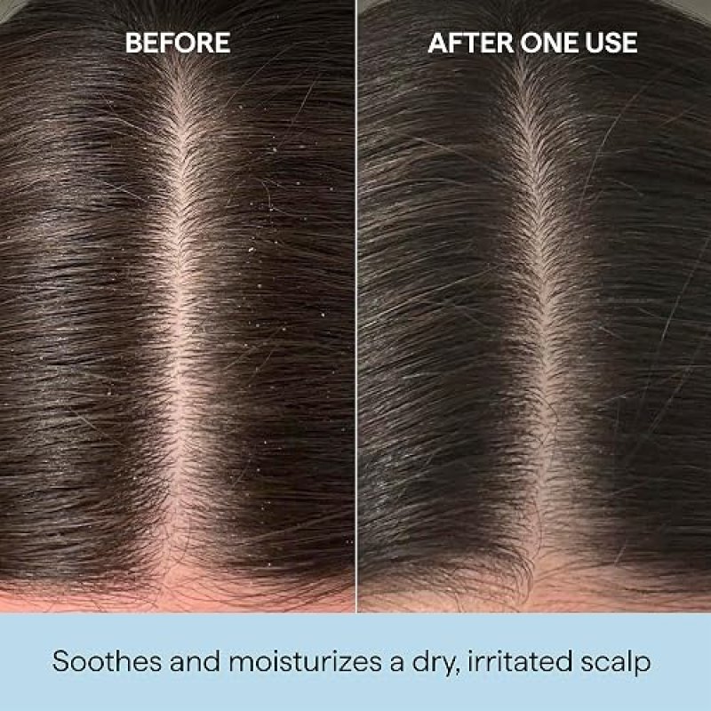 BRIOGEO SCALP REVIVAL ROSEMARY PRE-WASH OIL MOISTURIZING, SOOTHING, VEGAN HAIR TREATMENT