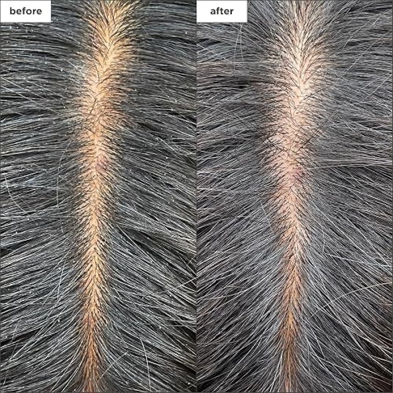 BRIOGEO SCALP REVIVAL CHARCOAL TEA TREE COOLING HYDRATION MASK FOR HEALTHY SCALP