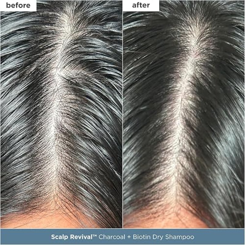 BRIOGEO SCALP REVIVAL SET CHARCOAL TEA TREE DETOX, HYDRATE SCALP CARE, VEGAN CRUELTY-FREE