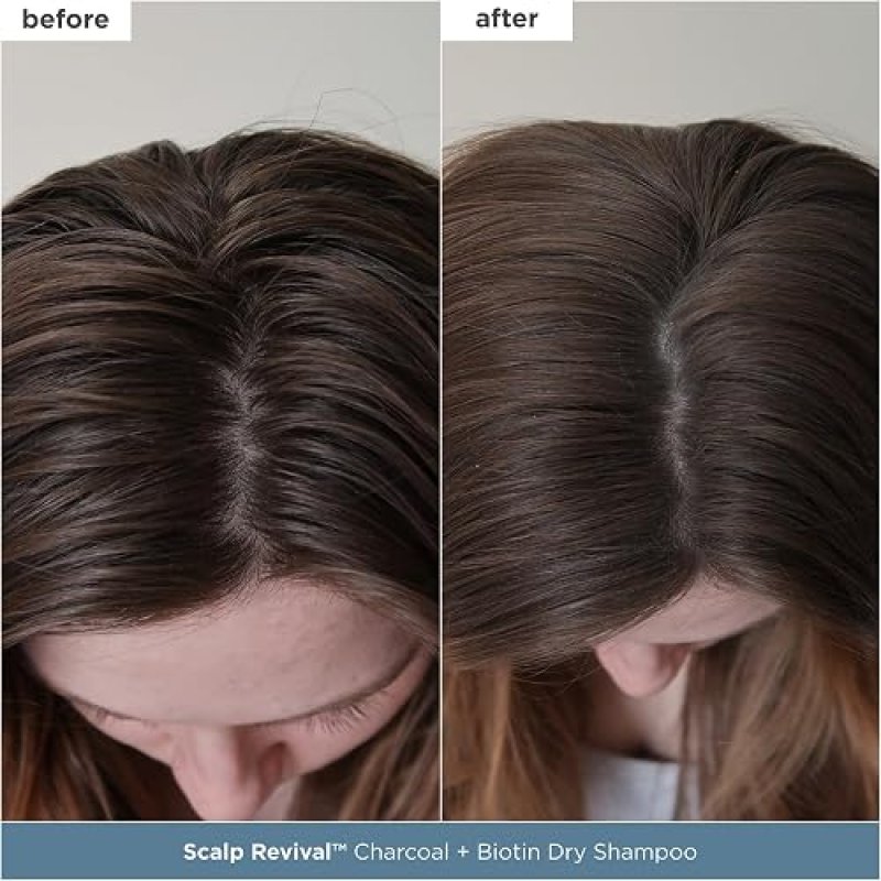 BRIOGEO SCALP REVIVAL SET CHARCOAL TEA TREE DETOX, HYDRATE SCALP CARE, VEGAN CRUELTY-FREE