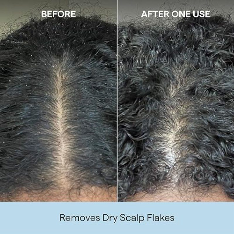 BRIOGEO SCALP REVIVAL CHARCOAL COCONUT OIL SHAMPOO SULFATE-FREE, DETOX HYDRATE, VEGAN