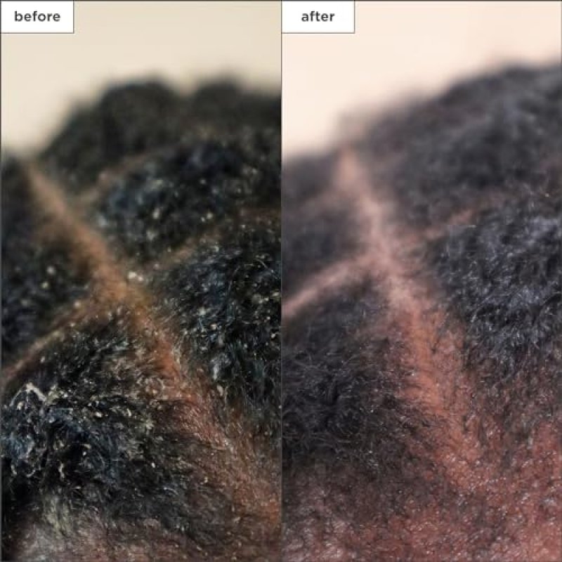 BRIOGEO SCALP REVIVAL SHAMPOO AND TREATMENT BUNDLE OIL AND SERUM FOR HEALTHY SCALP